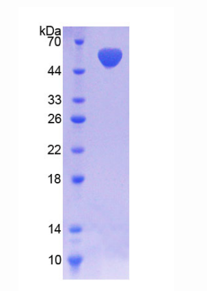 NAD激酶(NADK)重組蛋白,Recombinant NAD Kinase (NADK)