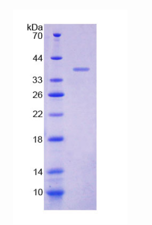 肌間蛋白2(MYOM2)重組蛋白,Recombinant Myomesin 2 (MYOM2)