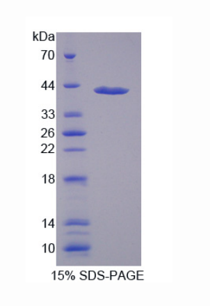 亚甲基四氢叶酸还原酶(MTHFR)重组蛋白,Recombinant Methylenetetrahydrofolate Reductase (MTHFR)