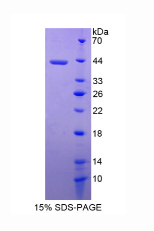 黑素瘤抑制性活性蛋白1(MIA1)重组蛋白,Recombinant Melanoma Inhibitory Activity Protein 1 (MIA1)