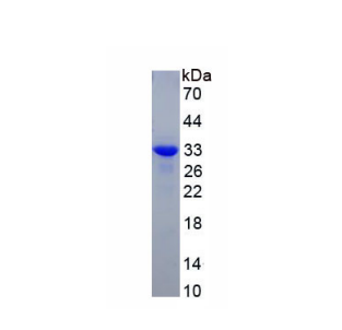 镍纹蛋白(METRN)重组蛋白,Recombinant Meteorin (METRN)