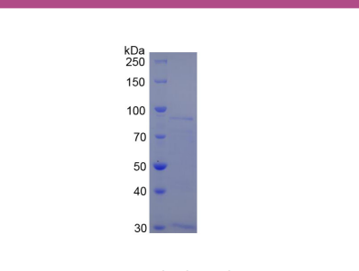 甲硫氨酰氨肽酶2(METAP2)重组蛋白,Recombinant Methionyl Aminopeptidase 2 (METAP2)