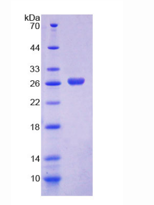 NADP依赖性苹果酶2(ME2)重组蛋白,Recombinant Malic Enzyme 2, NADP+ Dependent, Mitochondrial (ME2)