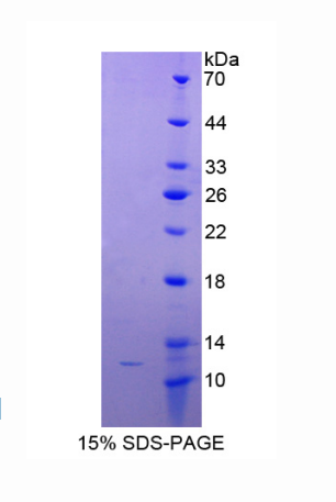 MYC关联因子X(MAX)重组蛋白,Recombinant MYC Associated Factor X (MAX)