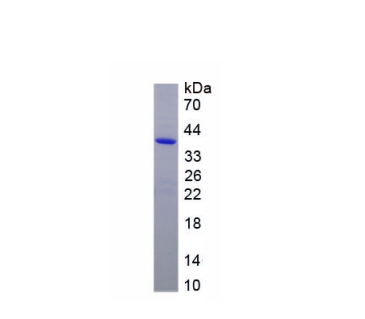 十四烷基化丙氨酸豐富蛋白激酶C底物(MARCKS)重組蛋白,Recombinant Myristoylated Alanine Rich Protein Kinase C Substrate (MARCKS)