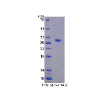 亮氨酸豐富重復(fù)激酶2(LRRK2)重組蛋白,Recombinant Leucine Rich Repeat Kinase 2 (LRRK2)