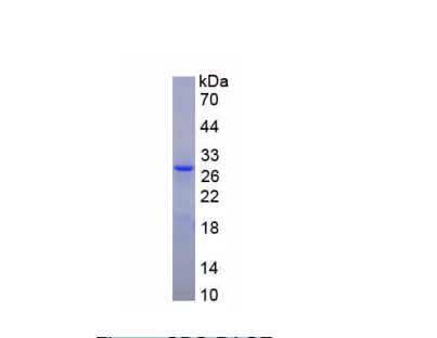 亮氨酰/半胱氨酰氨肽酶(LNPEP)重組蛋白,Recombinant Leucyl/Cystinyl Aminopeptidase (LNPEP)