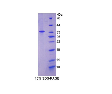 甘露糖结合凝集素2(LMAN2)重组蛋白,Recombinant Lectin, Mannose Binding 2 (LMAN2)