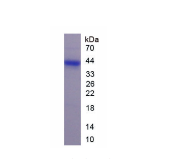 可罗索(KL)重组蛋白,Recombinant Klotho (KL)