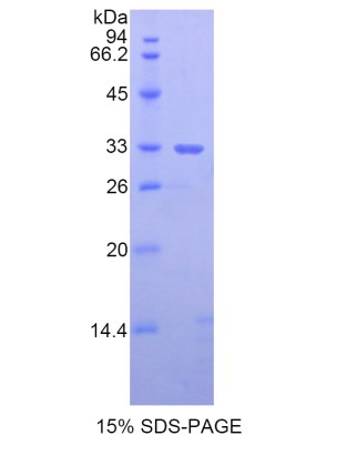 中间α-球蛋白抑制因子H5(ITIH5)重组蛋白,Recombinant Inter Alpha-Globulin Inhibitor H5 (ITIH5)