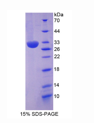 中间α-球蛋白抑制因子H2(ITIH2)重组蛋白,Recombinant Inter Alpha-Globulin Inhibitor H2 (ITIH2)