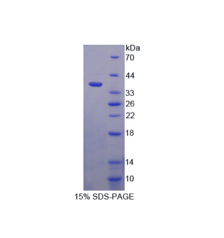 中间α-球蛋白抑制因子H1(ITIH1)重组蛋白,Recombinant Inter Alpha-Globulin Inhibitor H1 (ITIH1)