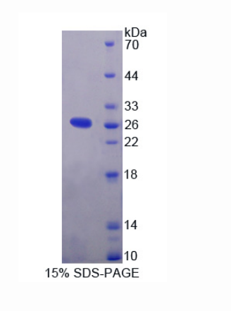 白介素1受体辅助蛋白样蛋白2(IL1RAPL2)重组蛋白,Recombinant Interleukin 1 Receptor Accessory Protein Like Protein 2 (IL1RAPL2)