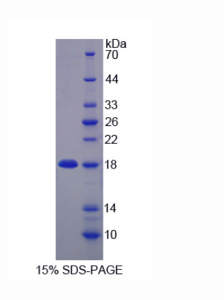 含锌飘带域蛋白1(ZNRD1)重组蛋白,Recombinant Zinc Ribbon Domain Containing Protein 1 (ZNRD1)