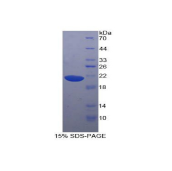 Hornerin蛋白(HRNR)重组蛋白,Recombinant Hornerin (HRNR)