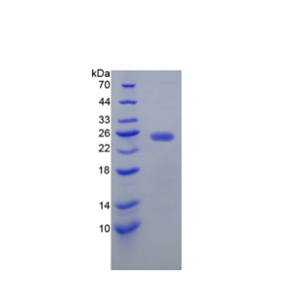 N-乙酰半乳糖胺酶α(NAGa)重组蛋白,Recombinant N-Acetylgalactosaminidase Alpha (NAGa)