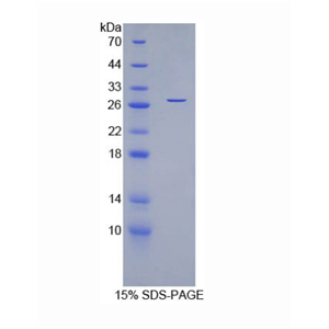 肌纤蛋白(MYOC)重组蛋白,Recombinant Myocilin (MYOC)