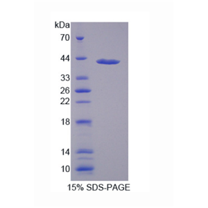 亚甲基四氢叶酸还原酶(MTHFR)重组蛋白,Recombinant Methylenetetrahydrofolate Reductase (MTHFR)