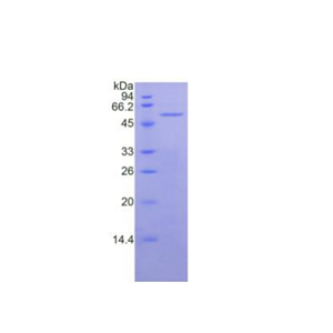 间皮素(MSLN)重组蛋白