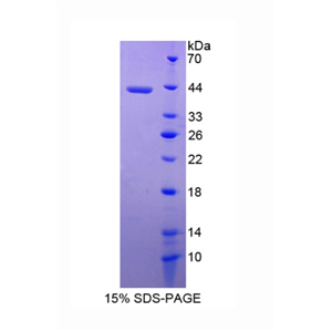 黑素瘤抑制性活性蛋白1(MIA1)重组蛋白