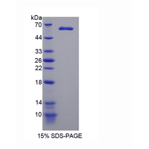 微管关联丝/苏氨酸激酶2(MAST2)重组蛋白