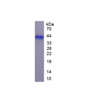 可罗索(KL)重组蛋白,Recombinant Klotho (KL)