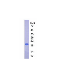 白介素18结合蛋白(IL18BP)重组蛋白