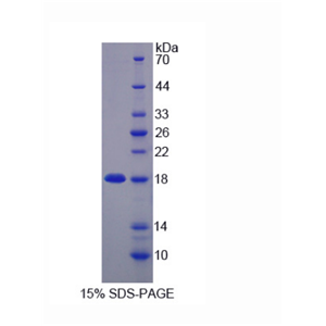 含锌飘带域蛋白1(ZNRD1)重组蛋白,Recombinant Zinc Ribbon Domain Containing Protein 1 (ZNRD1)