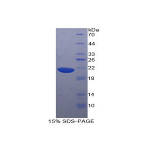 Hornerin蛋白(HRNR)重组蛋白,Recombinant Hornerin (HRNR)