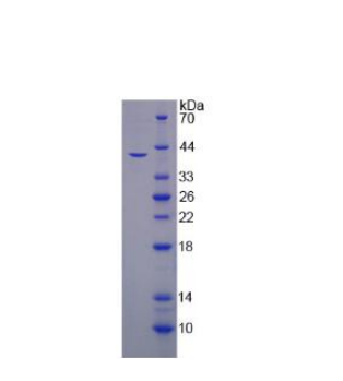 膜鐵轉(zhuǎn)運(yùn)輔助蛋白(HEPH)重組蛋白,Recombinant Hephaestin (HEPH)