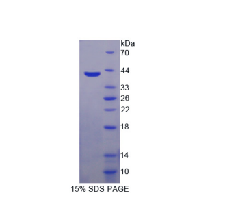 糖基化磷脂酰肌醇特异性磷脂酶D1(GPLD1)重组蛋白,Recombinant Glycosylphosphatidylinositol Specific Phospholipase D1 (GPLD1)