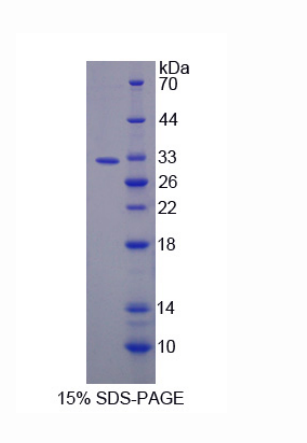 线粒体甘油-3-磷酸酰基转移酶(GPAM)重组蛋白,Recombinant Glycerol-3-Phosphate Acyltransferase, Mitochondrial (GPAM)