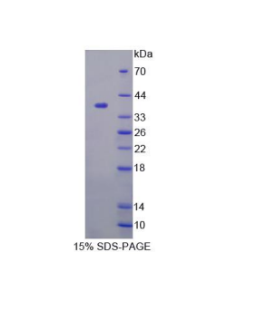 谷氨酰胺酶(GLS)重組蛋白,Recombinant Glutaminase (GLS)