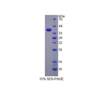 γ-谷氨酰水解酶(gGH)重組蛋白,Recombinant Gamma-Glutamyl Hydrolase (gGH)