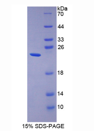 胃动蛋白2(GKN2)重组蛋白,Recombinant Gastrokine 2 (GKN2)