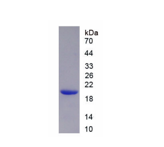 葡萄糖-6-磷酸酶催化亚基(G6PC)重组蛋白,Recombinant Glucose-6-Phosphatase, Catalytic (G6PC)