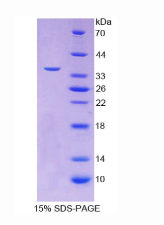 卵泡抑素样蛋白1(FSTL1)重组蛋白,Recombinant Follistatin Like Protein 1 (FSTL1)