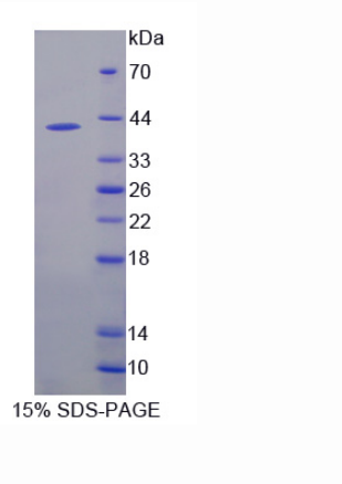 V-Ets骨髓成紅細胞增多癥病毒E26癌基因同源物1(ETS1)重組蛋白,Recombinant V-Ets Erythroblastosis Virus E26 Oncogene Homolog 1 (ETS1)