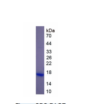 嗜酸性粒細(xì)胞過(guò)氧化物酶(EPX)重組蛋白,Recombinant Eosinophil Peroxidase (EPX)