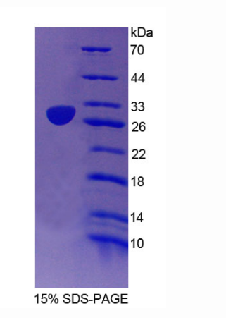 彈性蛋白微原纖維界面因子2(EMILIN2)重組蛋白,Recombinant Elastin Microfibril Interface Located Protein 2 (EMILIN2)