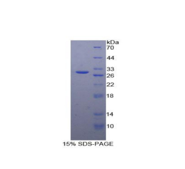 骺蛋白聚糖(EPYC)重組蛋白,Recombinant Epiphycan (EPYC)