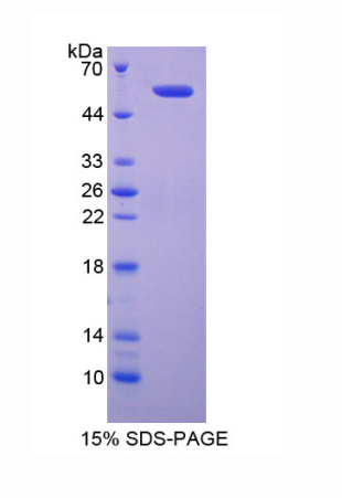 Diaphanous同源物1(DIAPH1)重组蛋白,Recombinant Diaphanous Homolog 1 (DIAPH1)