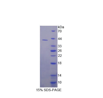 二氢乳清酸脱氢酶(DHODH)重组蛋白,Recombinant Dihydroorotate Dehydrogenase (DHODH)