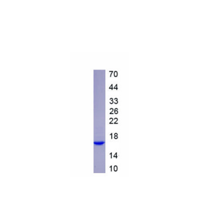 亨廷顿蛋白(HTT)重组蛋白,Recombinant Huntingtin (HTT)