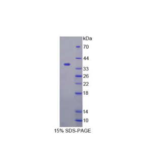 巨轴索神经蛋白(GAN)重组蛋白,Recombinant Gigaxonin (GAN)