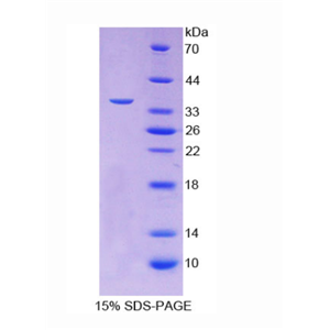 卵泡抑素样蛋白1(FSTL1)重组蛋白,Recombinant Follistatin Like Protein 1 (FSTL1)