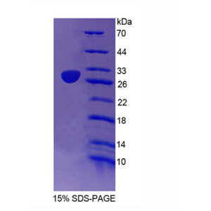 弹性蛋白微原纤维界面因子2(EMILIN2)重组蛋白,Recombinant Elastin Microfibril Interface Located Protein 2 (EMILIN2)