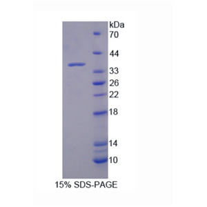 双特异性酪氨酸磷酸化调节激酶1A(DYRK1A)重组蛋白