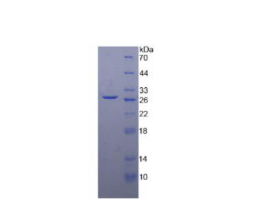 二酰甘油-O-?；D(zhuǎn)移酶同源物1(DGAT1)重組蛋白,Recombinant Diacylglycerol-O-Acyltransferase Homolog 1 (DGAT1)