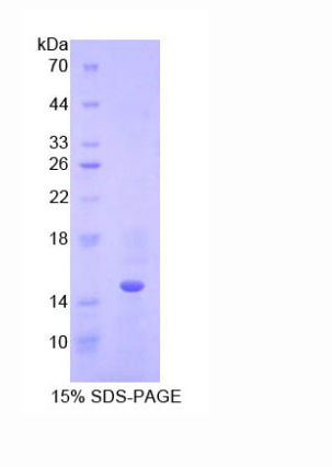 半胱氨酸蛋白酶抑制劑B(CSTB)重組蛋白,Recombinant Cystatin B (CSTB)